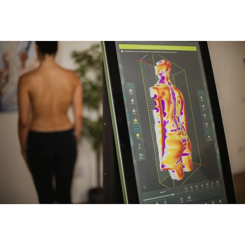Система 3D-диагностики позвоночника Sensor Medica Spine3D